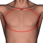 Chest infection